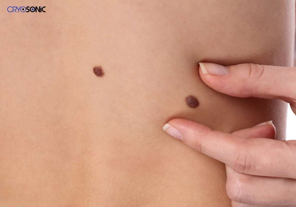 Infection Risk and Poor Aftercare Deal
